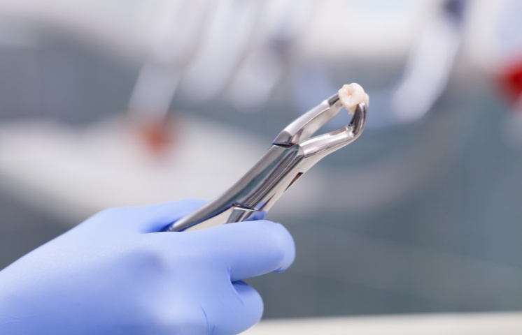 how long it takes to recover from tooth extraction