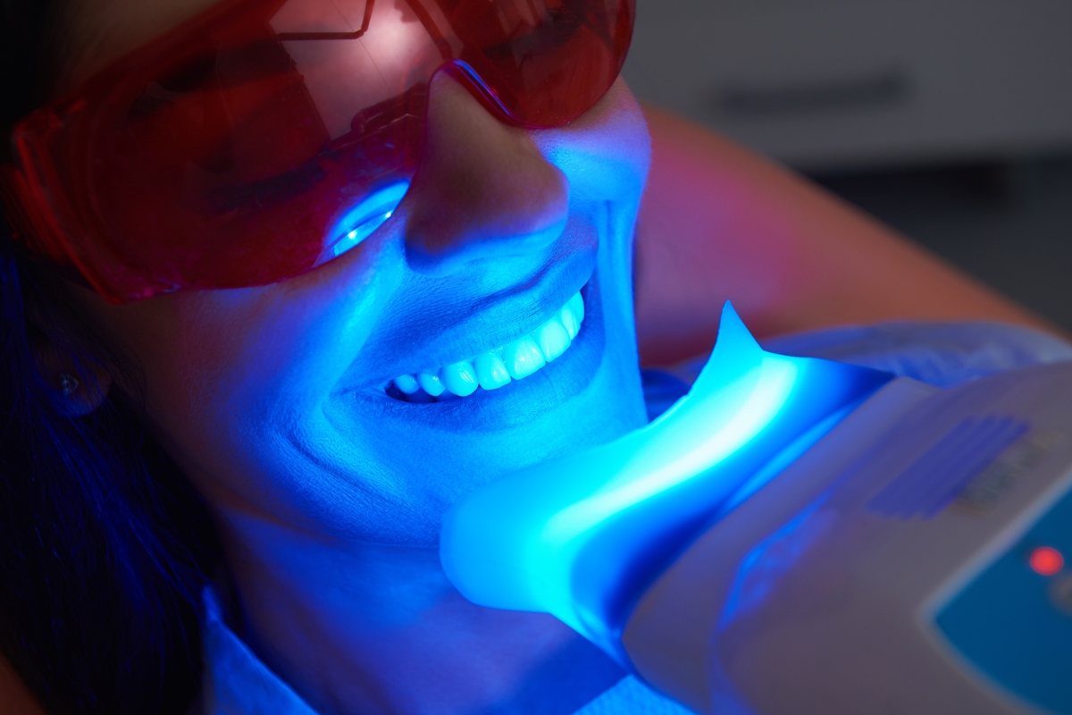 teeth-whitening-in-Buda
